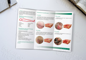 Буклет А4 «Пролежни» — фото 2