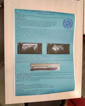 Плакат А1 курсовая работа «Лучевая диагностика» — фото 1