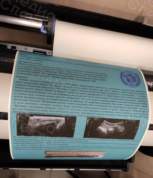 Плакат А1 курсовая работа «Лучевая диагностика» — фото 3